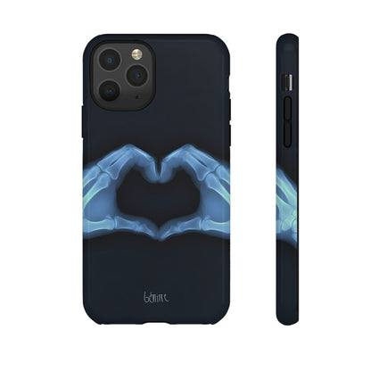 Bone Deep Tough Case