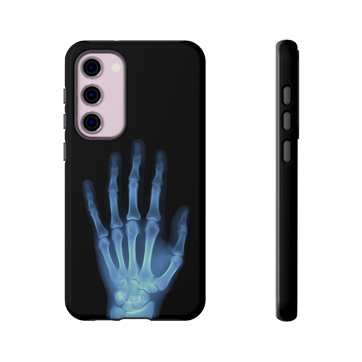 The Radiograph Tough Case