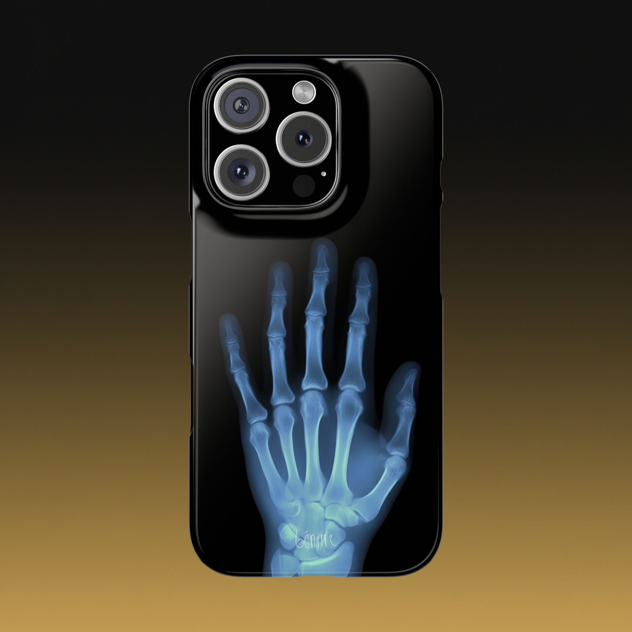 レントゲンライト