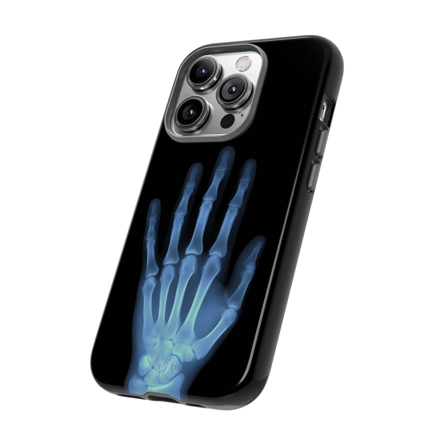 The Radiograph Tough Case
