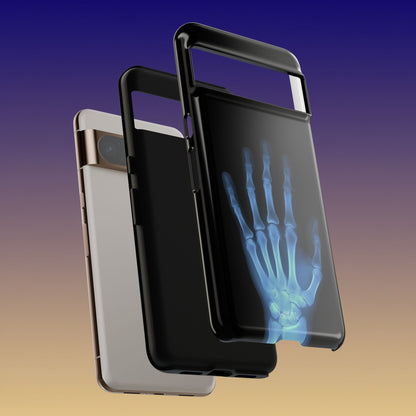 The Radiograph Tough Case