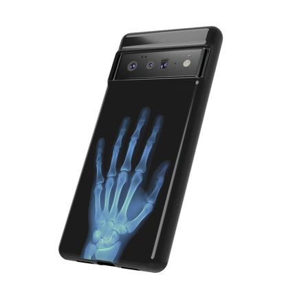 The Radiograph Tough Case