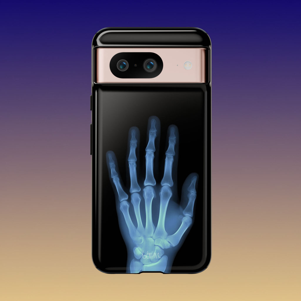 レントゲン写真