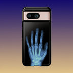 レントゲン写真