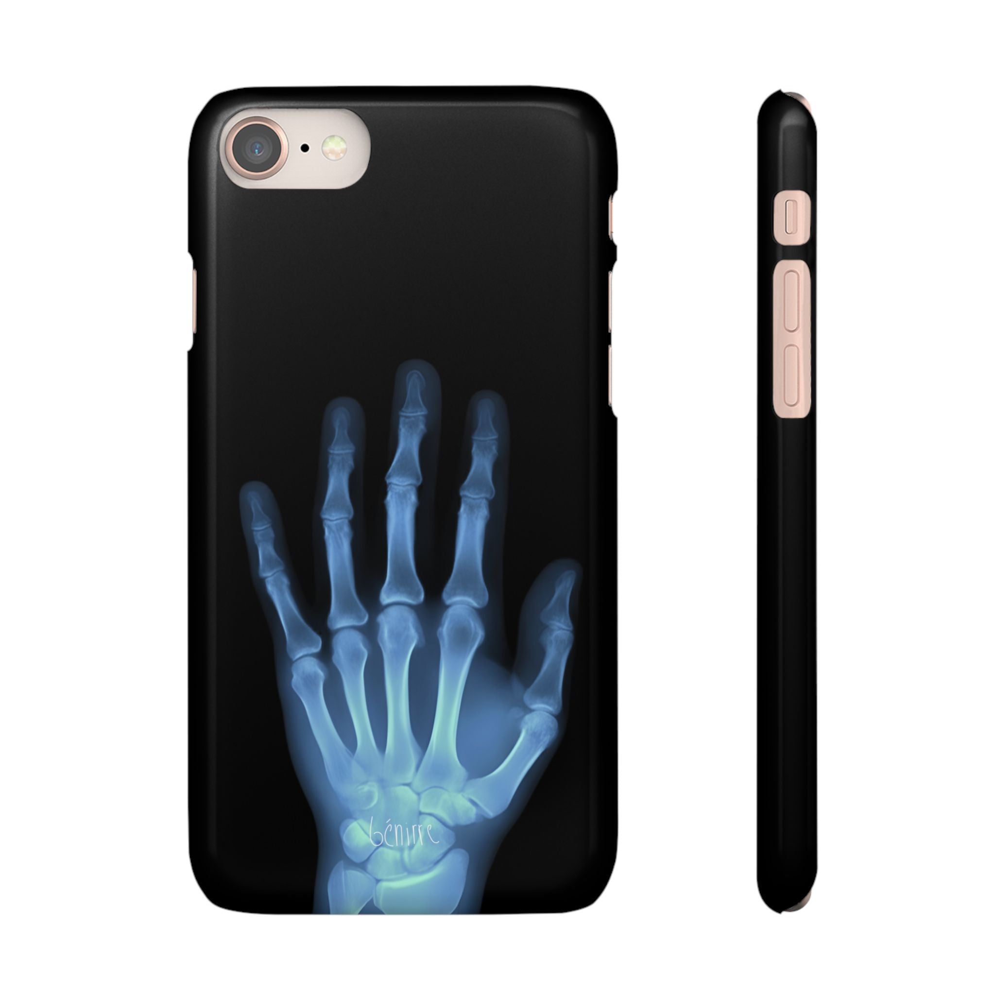 レントゲンライト