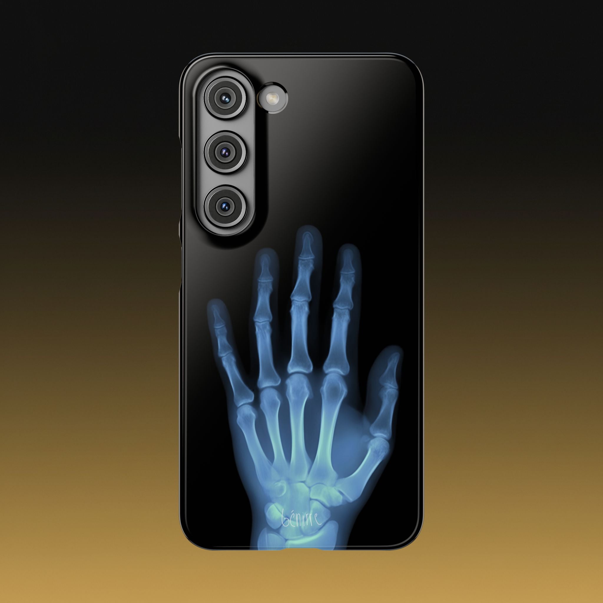 レントゲンライト