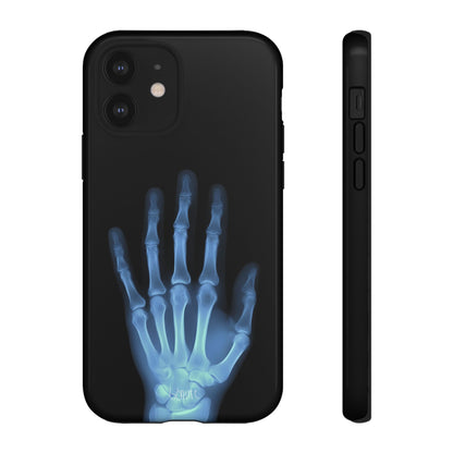The Radiograph Tough Case
