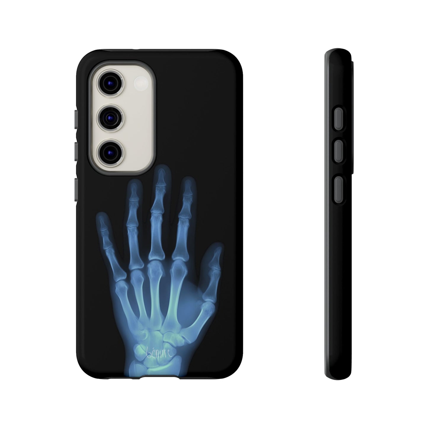 The Radiograph Tough Case
