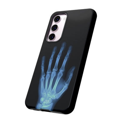 The Radiograph Tough Case