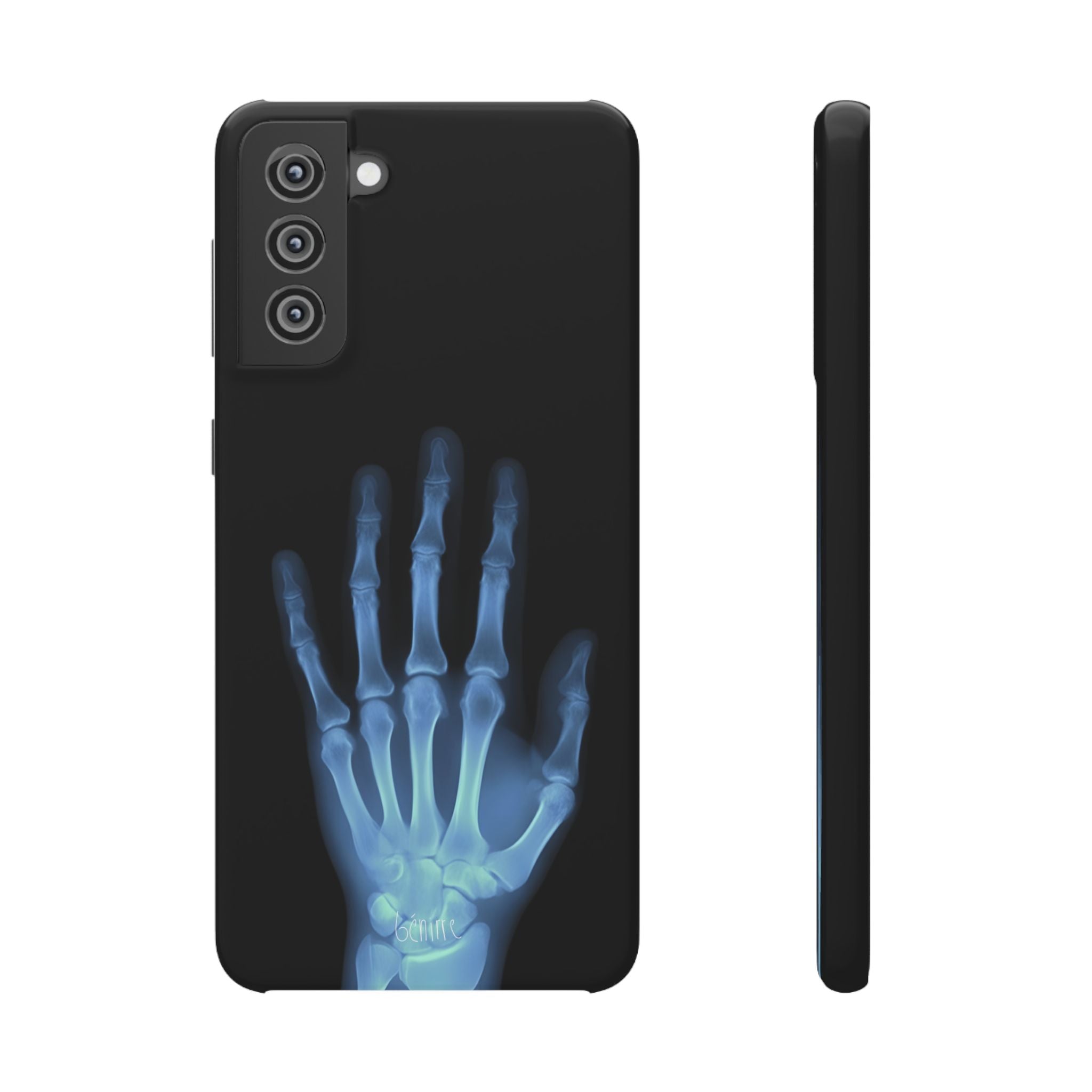 レントゲンライト