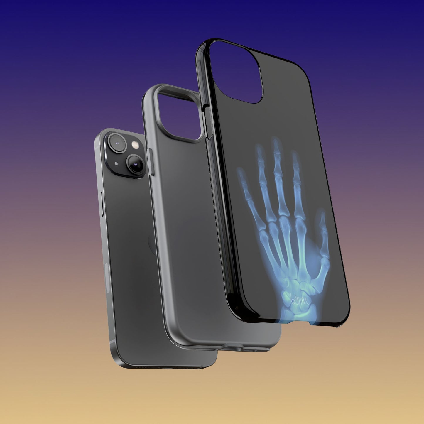 The Radiograph Tough Case