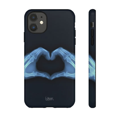 Bone Deep Tough Case