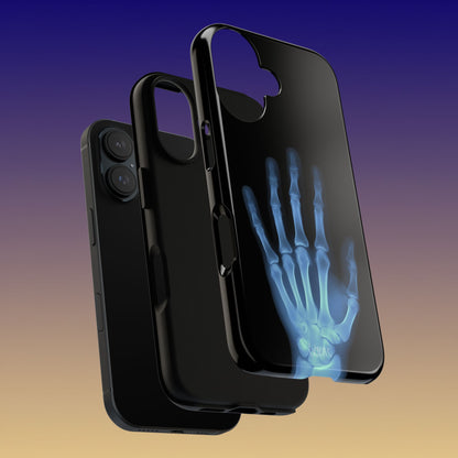 The Radiograph Tough Case