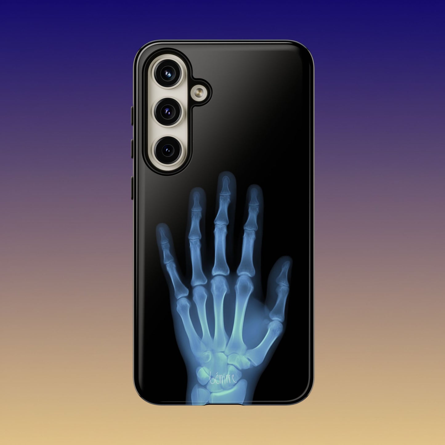 The Radiograph Tough Case