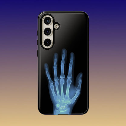 The Radiograph Tough Case