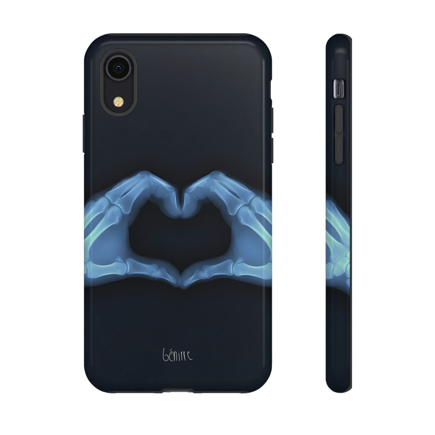 Bone Deep Tough Case