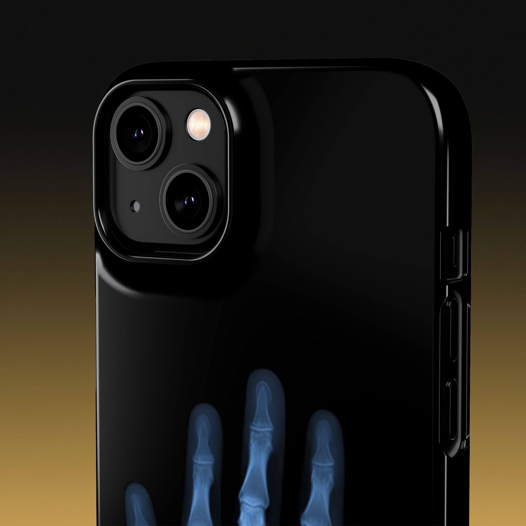 レントゲンライト