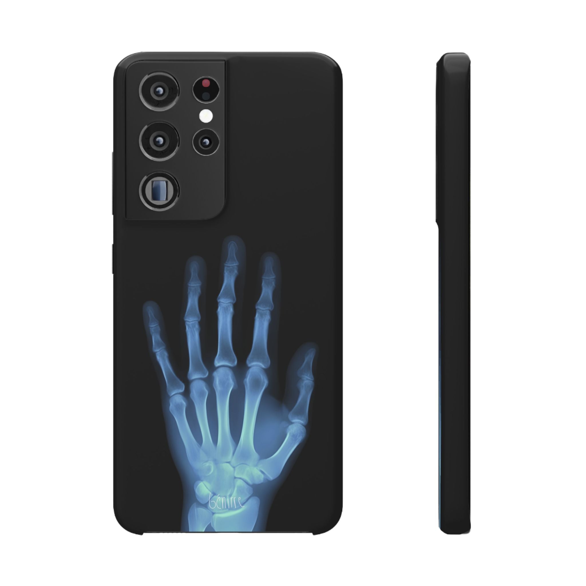 レントゲンライト