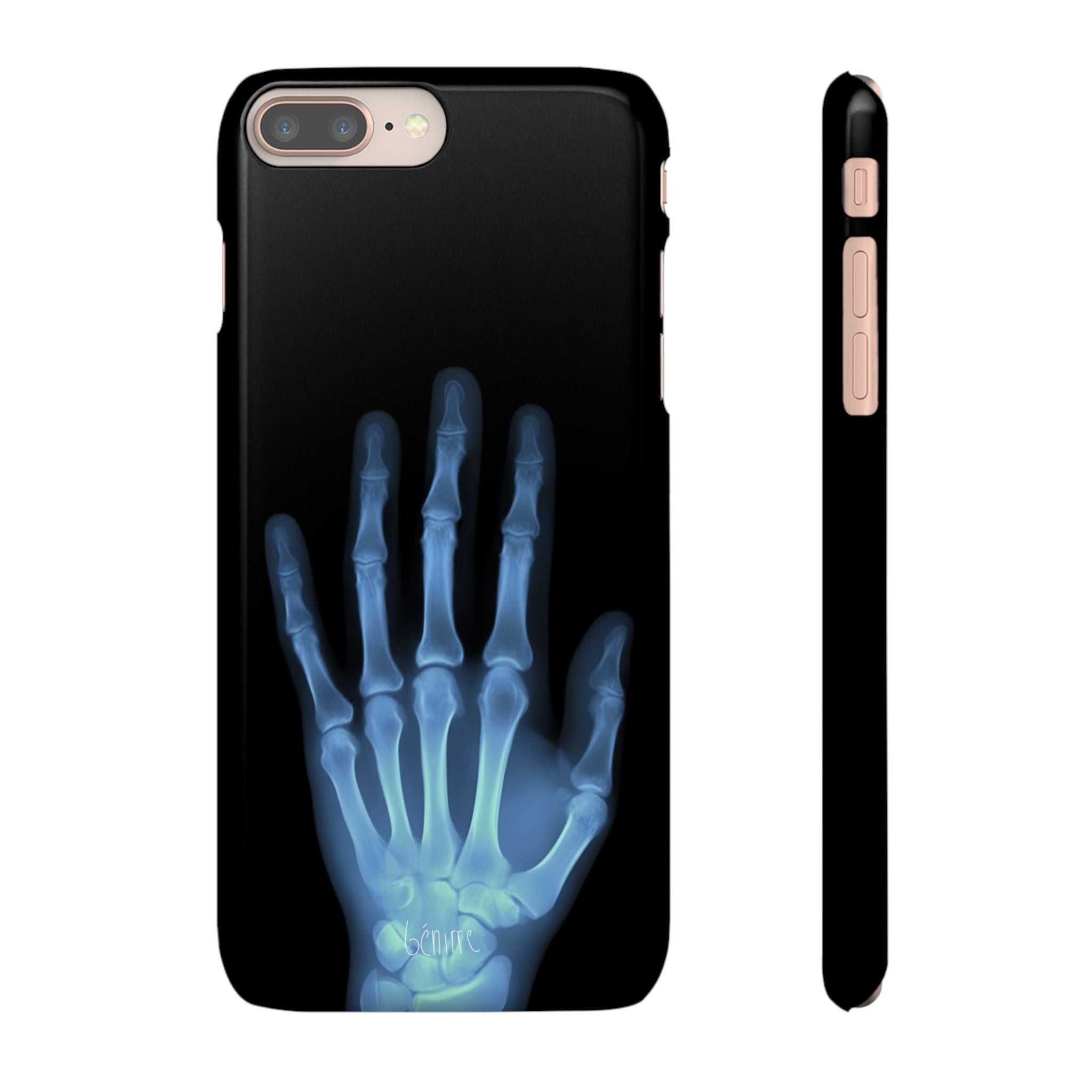 レントゲンライト