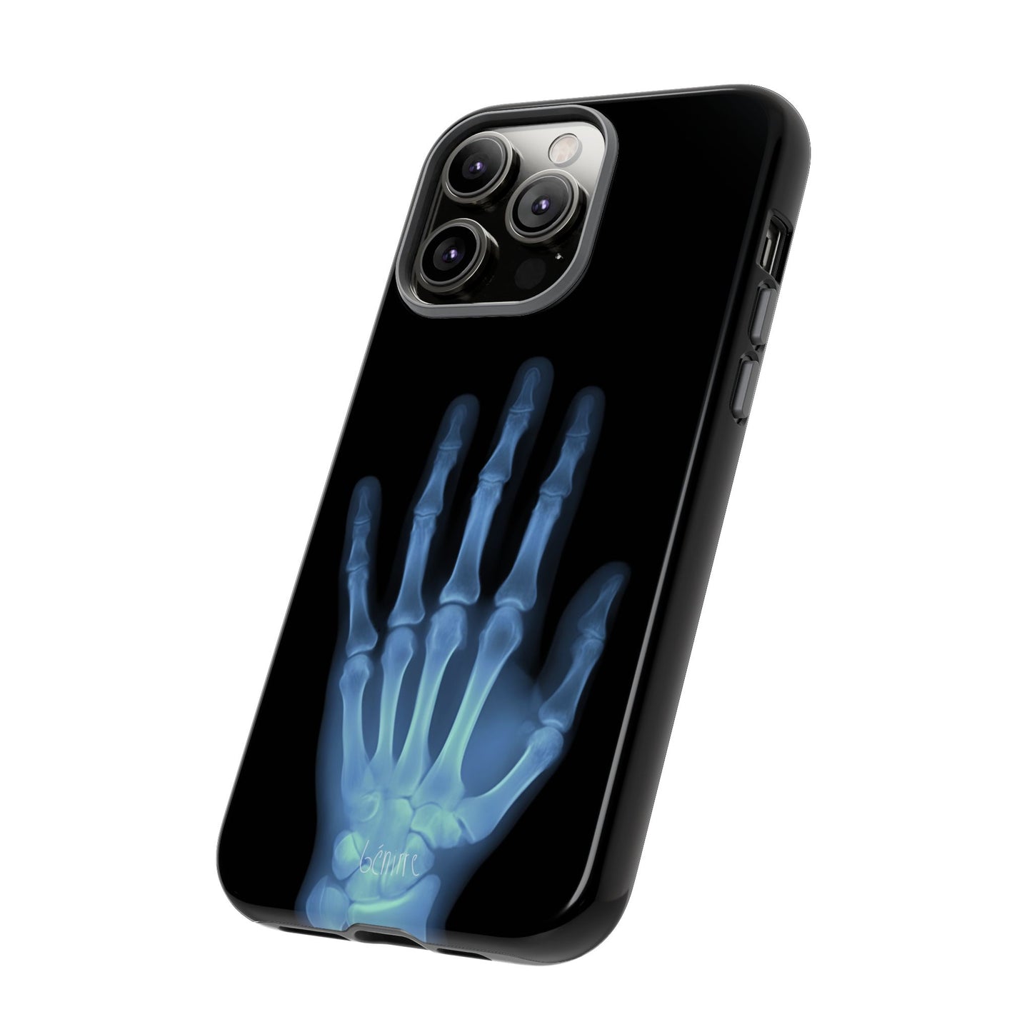 The Radiograph Tough Case