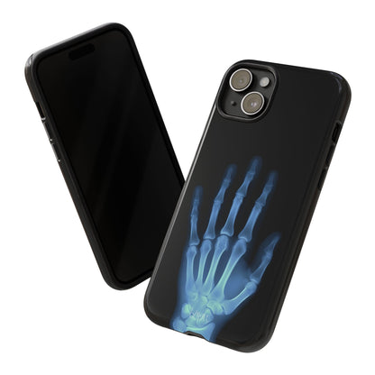 The Radiograph Tough Case