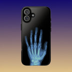 レントゲン写真