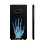 レントゲン写真