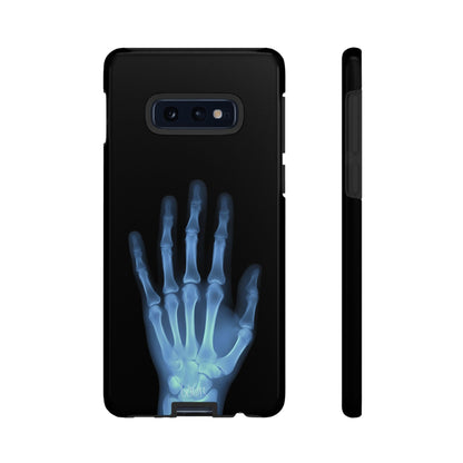 The Radiograph Tough Case