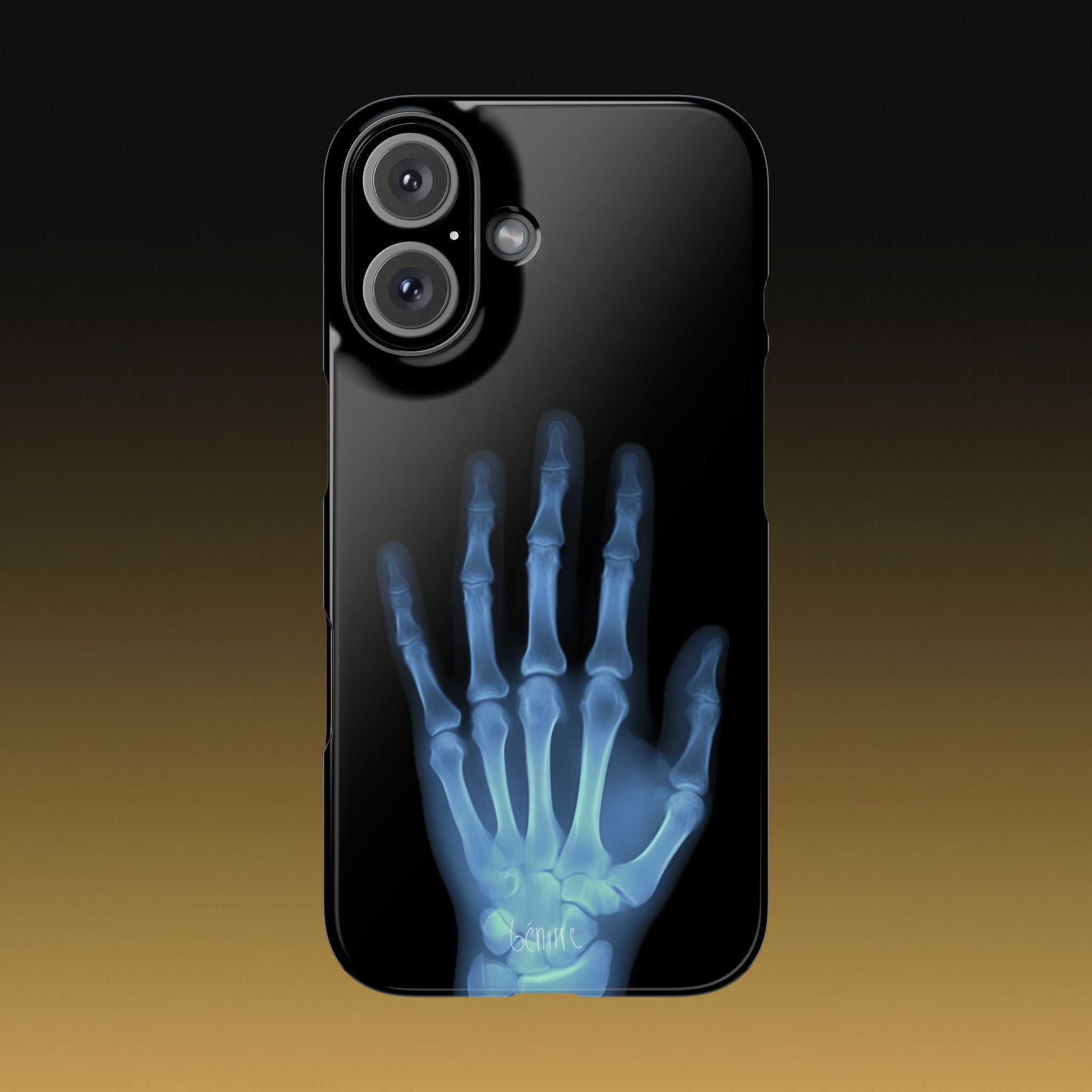 レントゲンライト