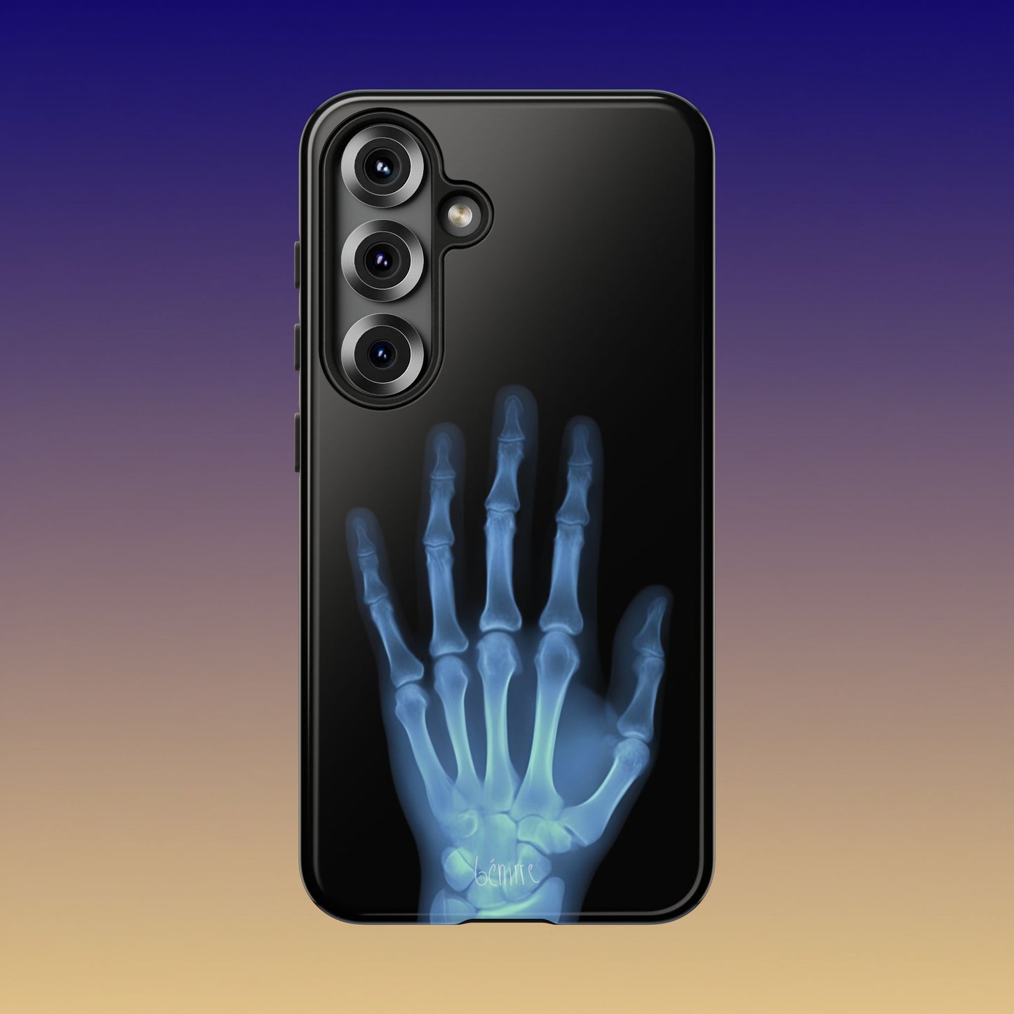 The Radiograph Tough Case