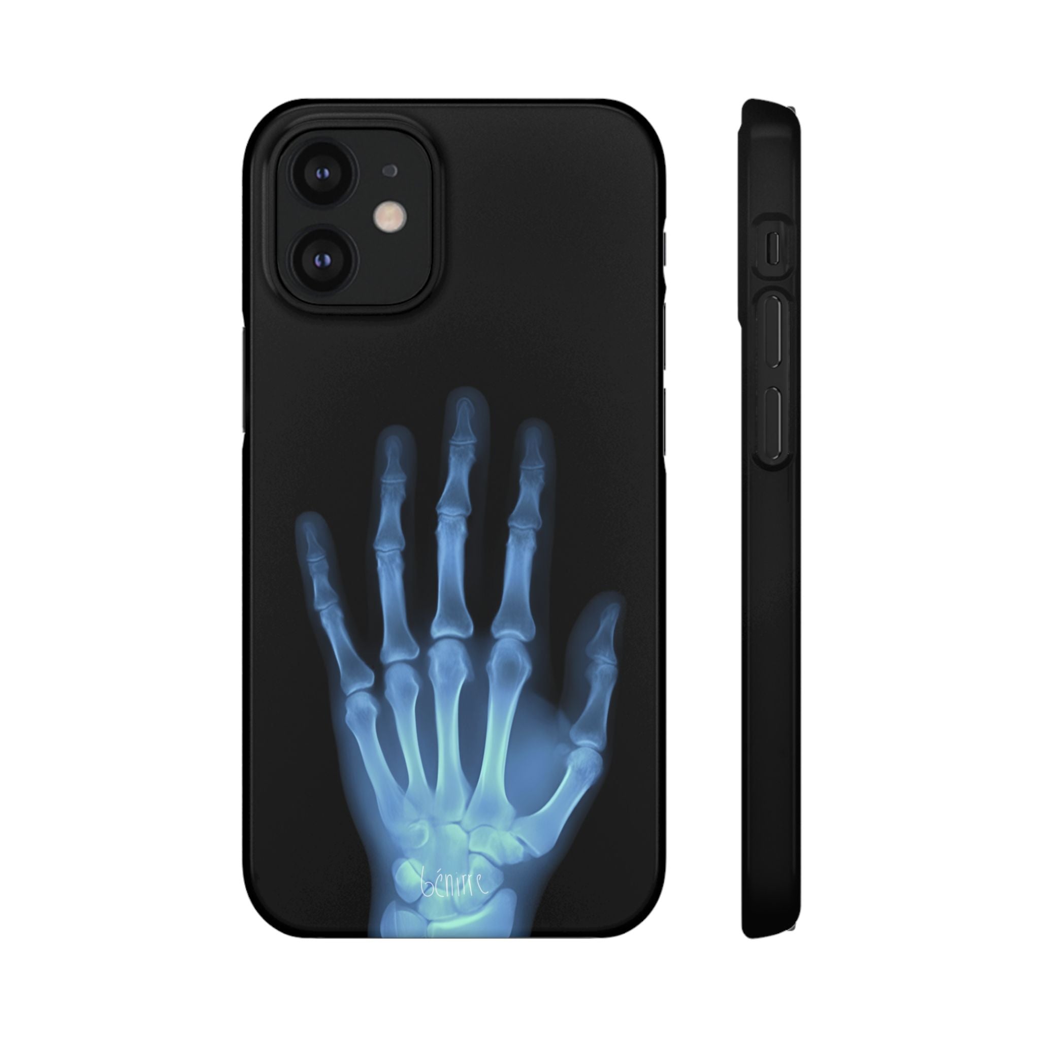 レントゲンライト