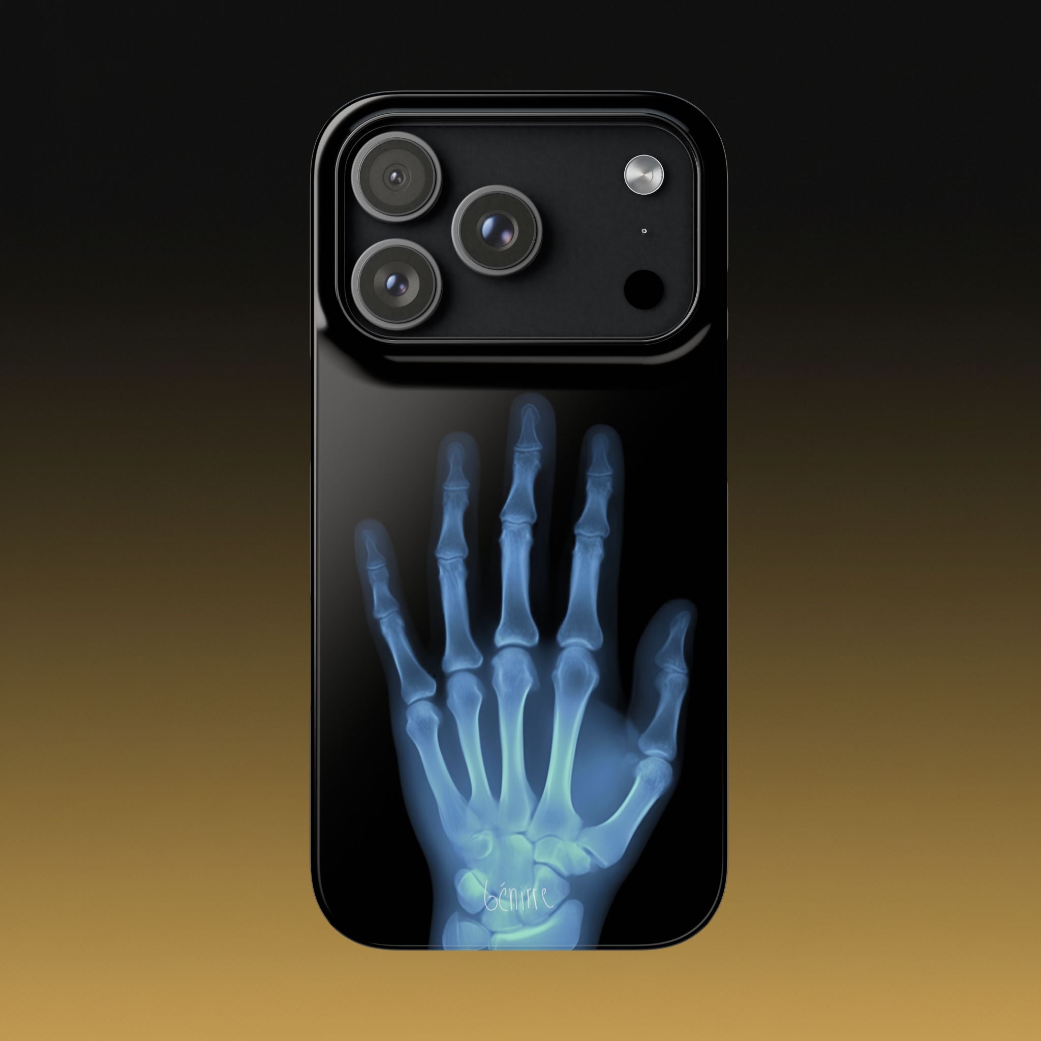 レントゲンライト