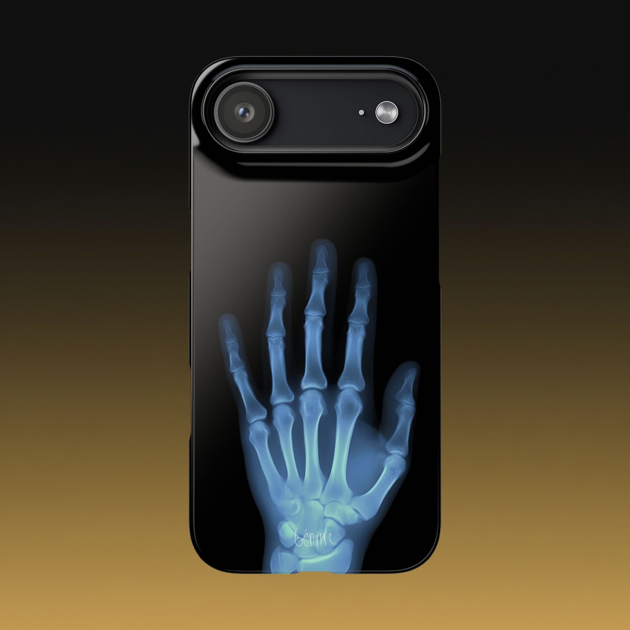 レントゲンライト