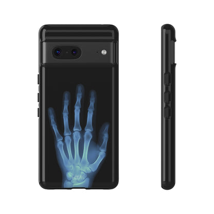 The Radiograph Tough Case