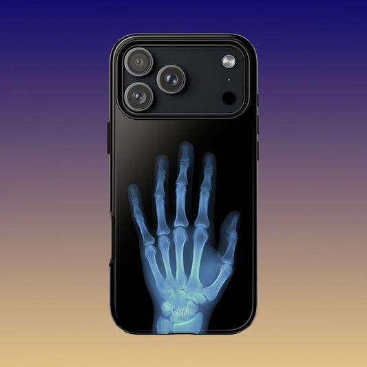 The Radiograph Tough Case