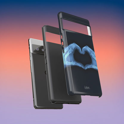 Bone Deep Tough Case