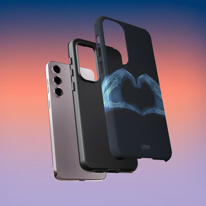 Bone Deep Tough Case