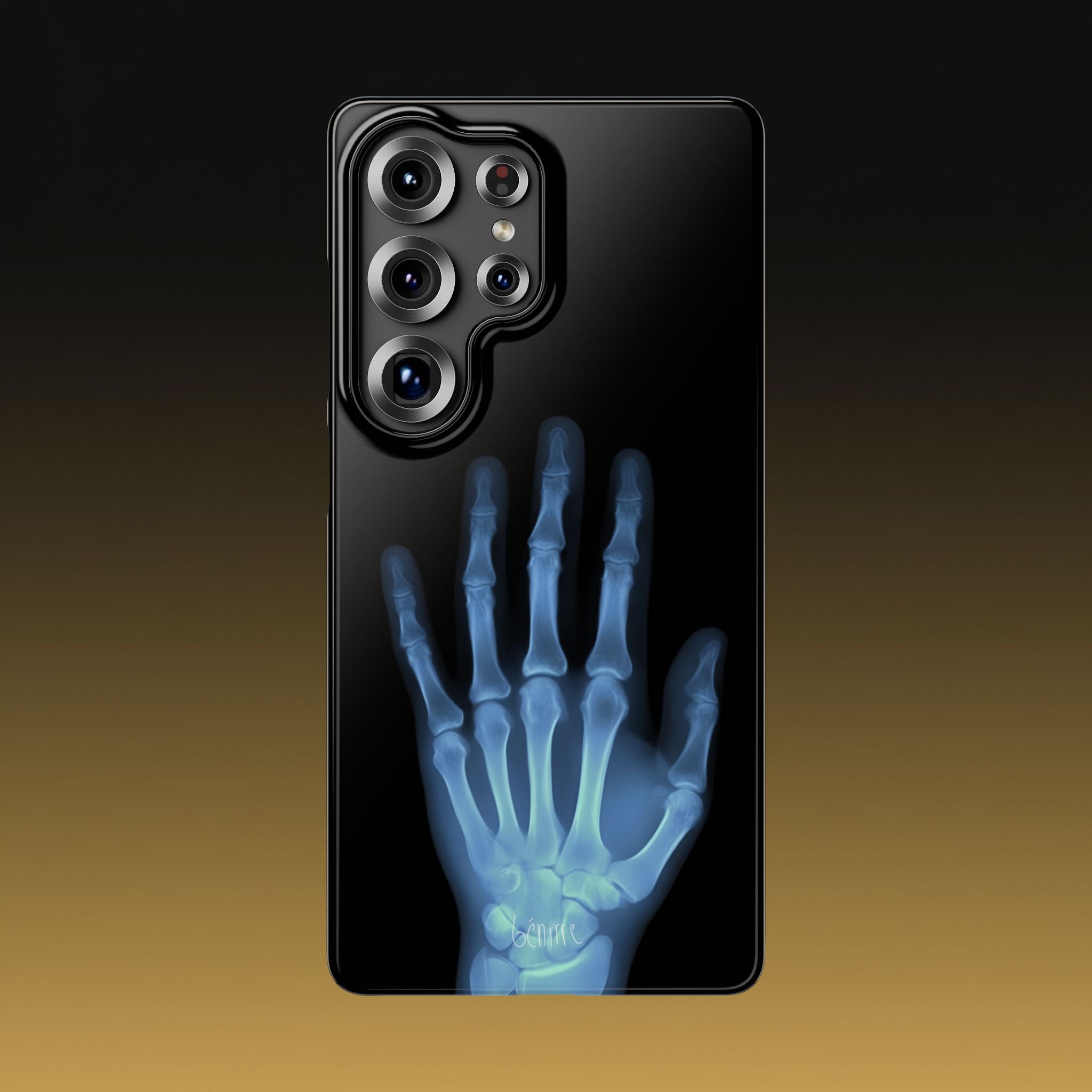 レントゲンライト