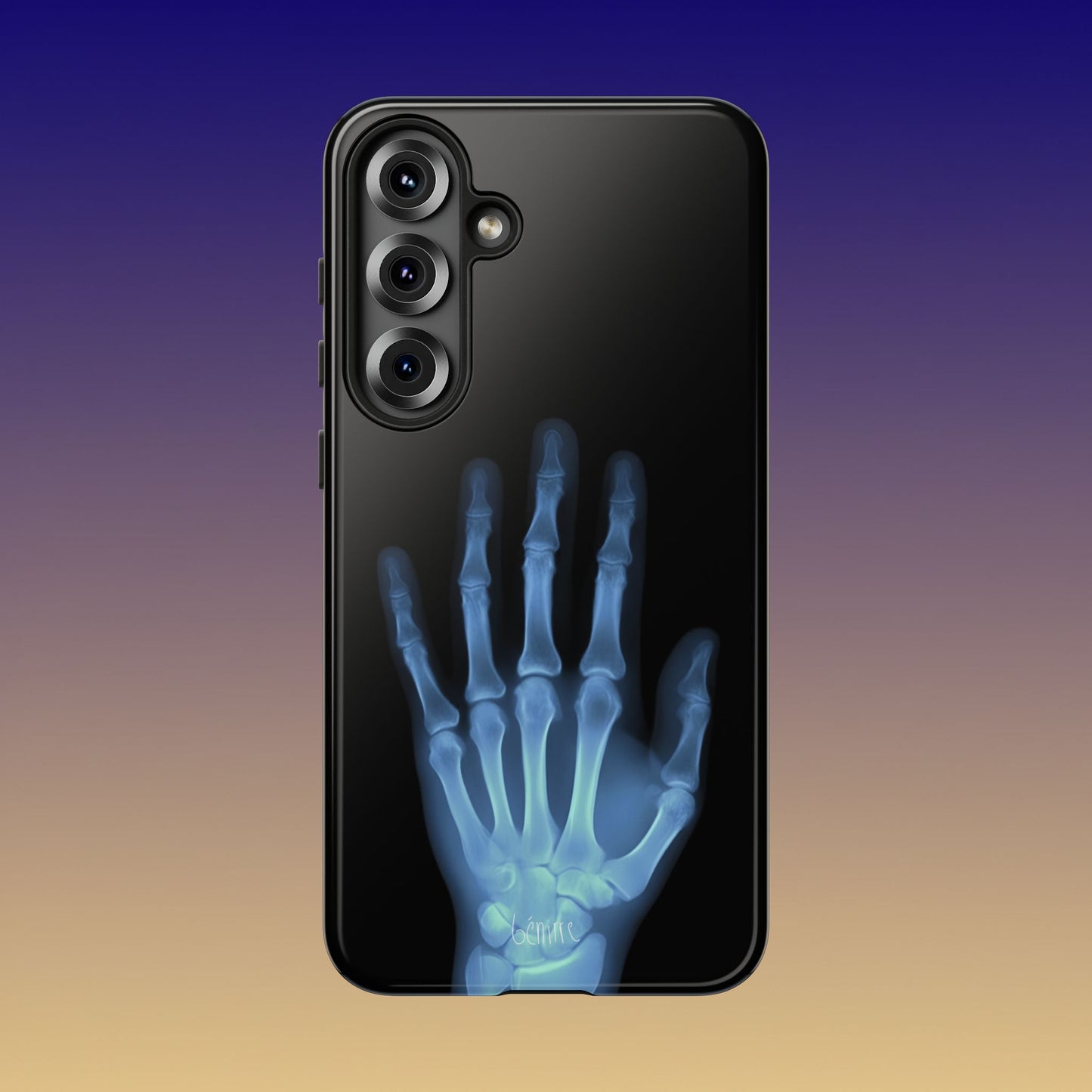 The Radiograph Tough Case