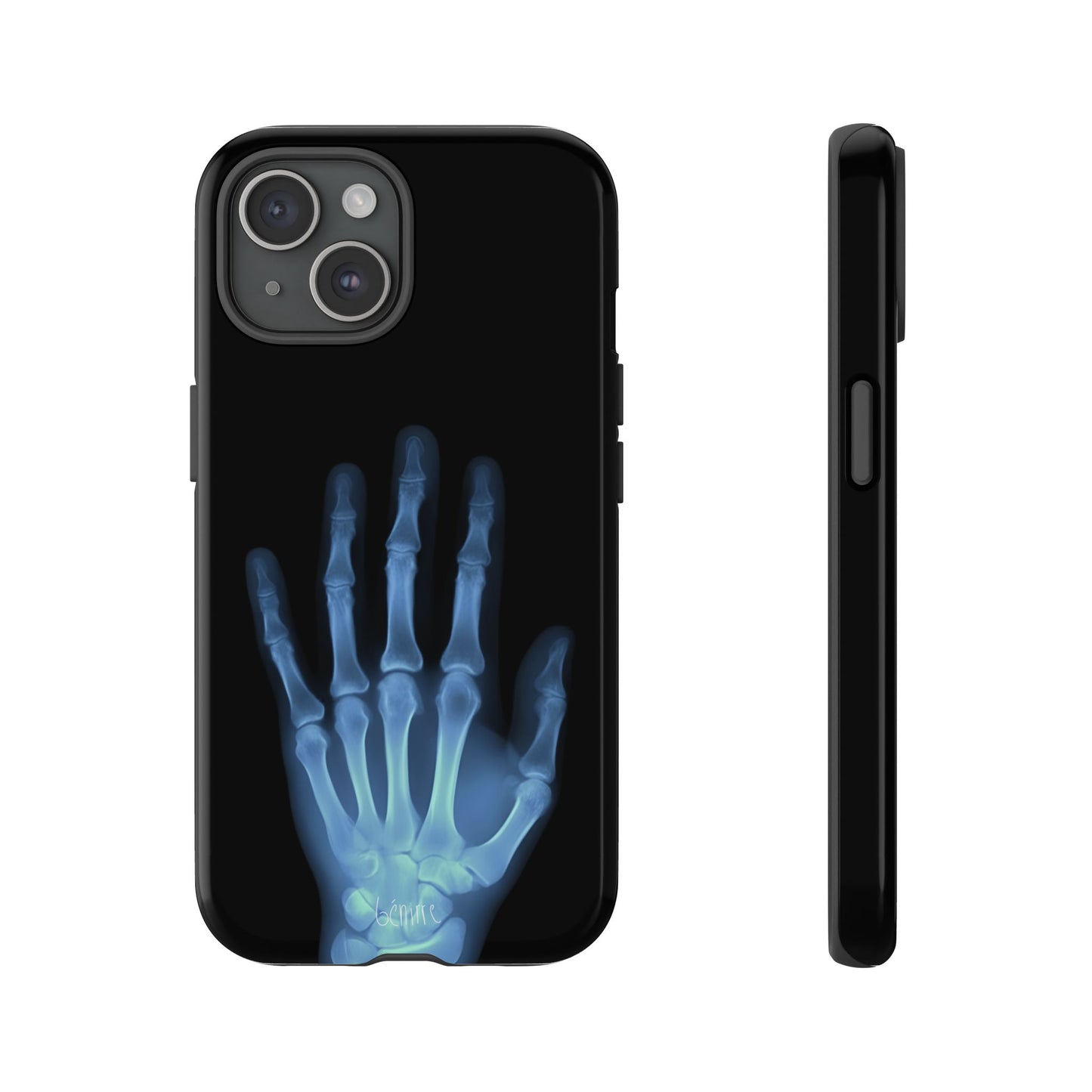The Radiograph Tough Case