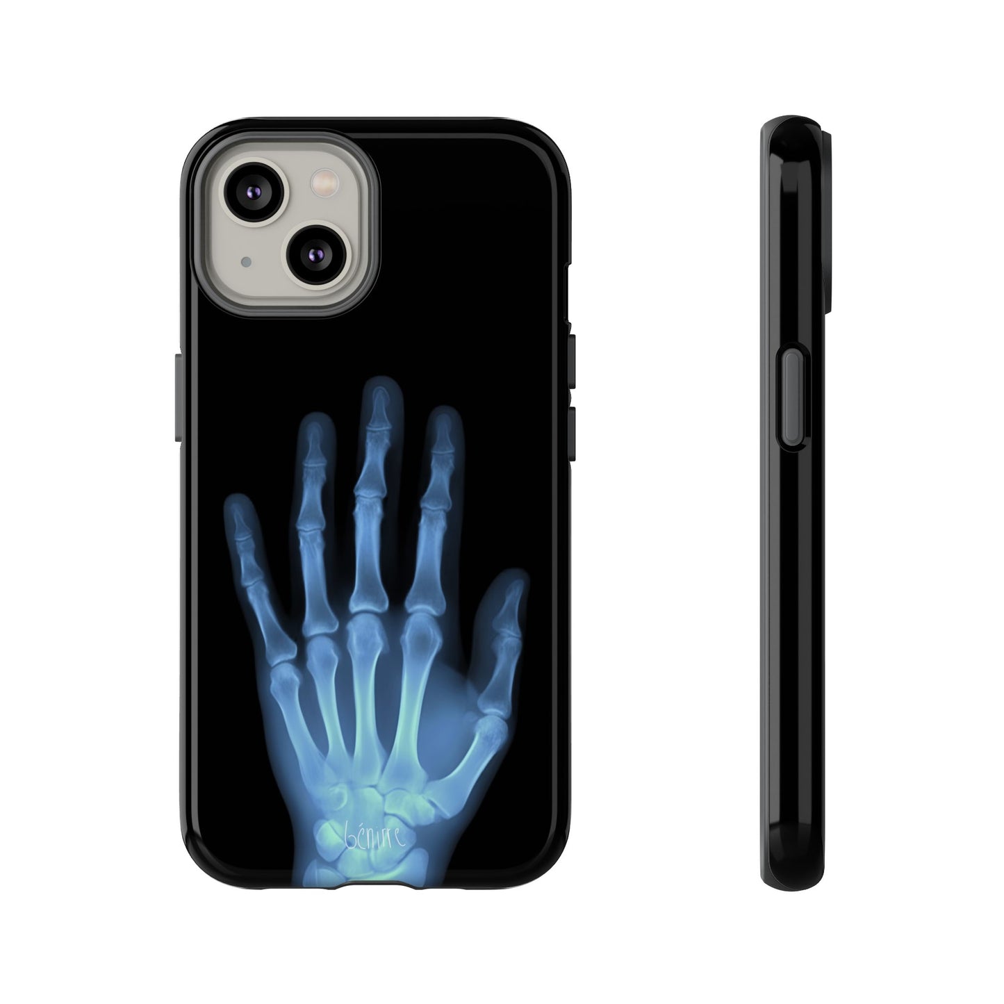 The Radiograph Tough Case