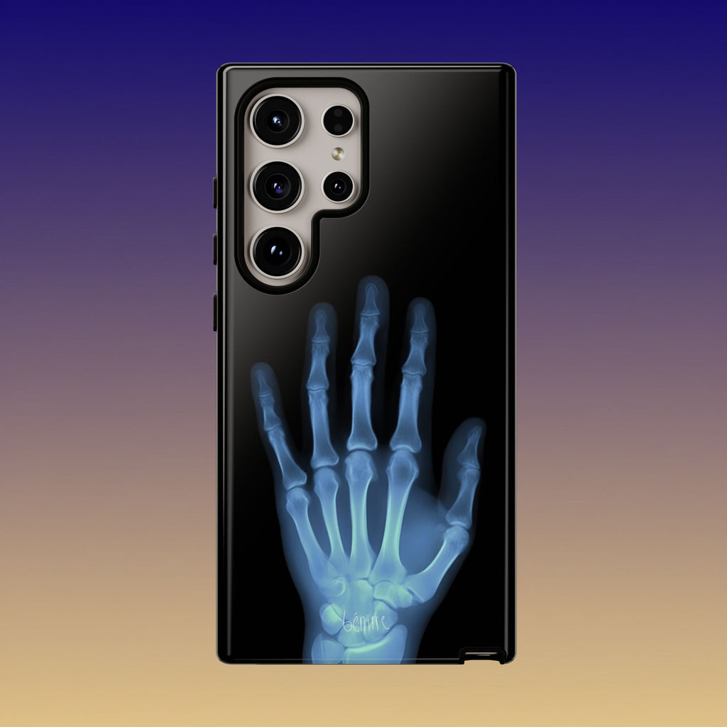 レントゲン写真