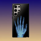 レントゲン写真