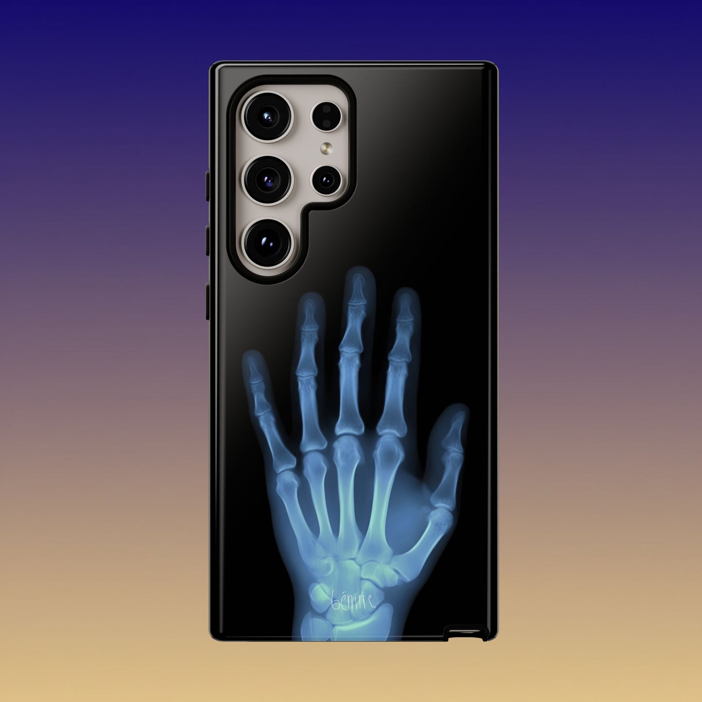 The Radiograph Tough Case