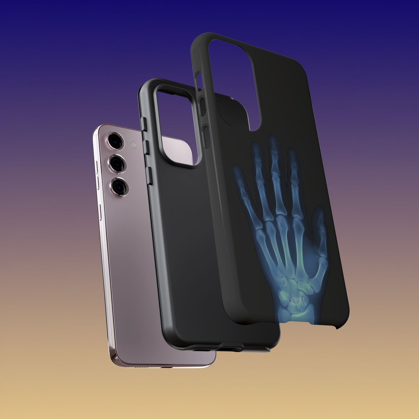 The Radiograph Tough Case