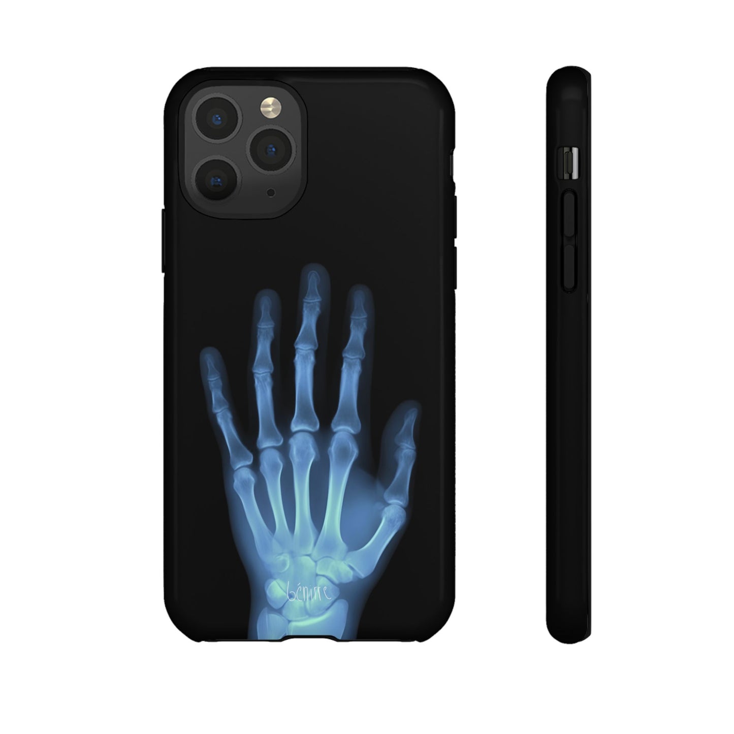 The Radiograph Tough Case