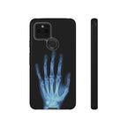 レントゲン写真