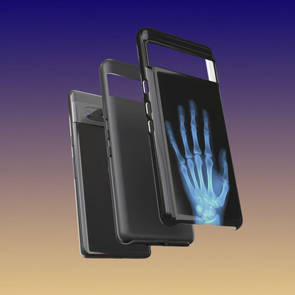 The Radiograph Tough Case