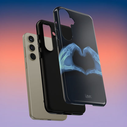 Bone Deep Tough Case