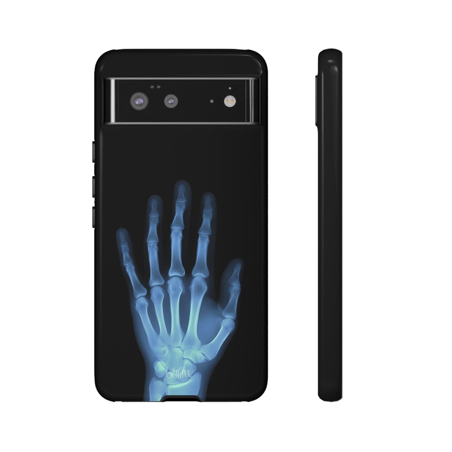 The Radiograph Tough Case